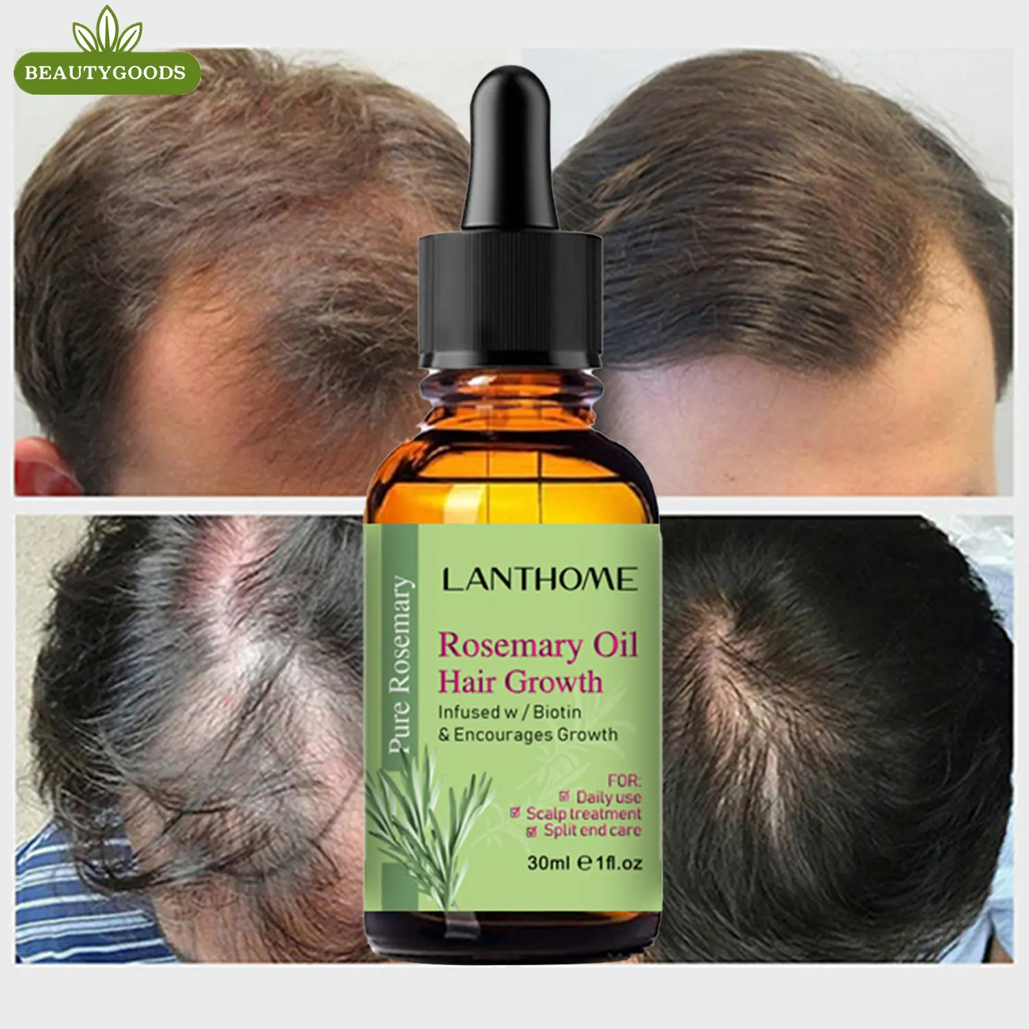 1 Pc Hair Growth Products Rosemary Anti Loss Oil Anti-loss Scalp Dry Frizzy Treatment Strong Root Essential Oils Follicles Care
1 Pc Hair Growth Products Rosemary Anti Loss Oil Anti-loss Scalp Dry Frizzy Treatment Strong Root Essential Oils Follicles Care
