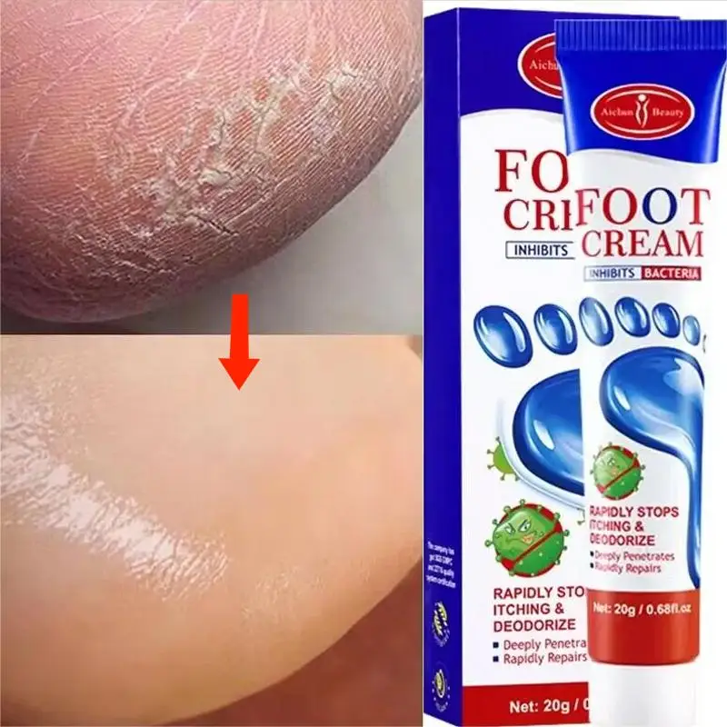 Herbal Anti Crack Foot Hand Cream Anti-Drying Heel Cracked Repair Removal Dead Skin Calluses Whitening Moisturizing Skin Care
Herbal Anti Crack Foot Hand Cream Anti-Drying Heel Cracked Repair Removal Dead Skin Calluses Whitening Moisturizing Skin Care