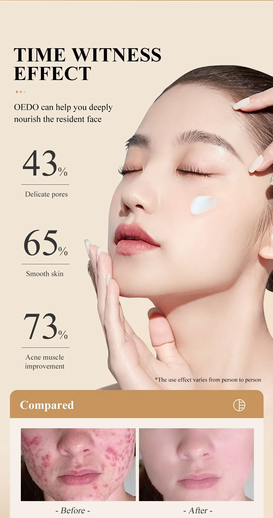 Ginseng Acne Cream: Repair, Whiten Skin Quickly