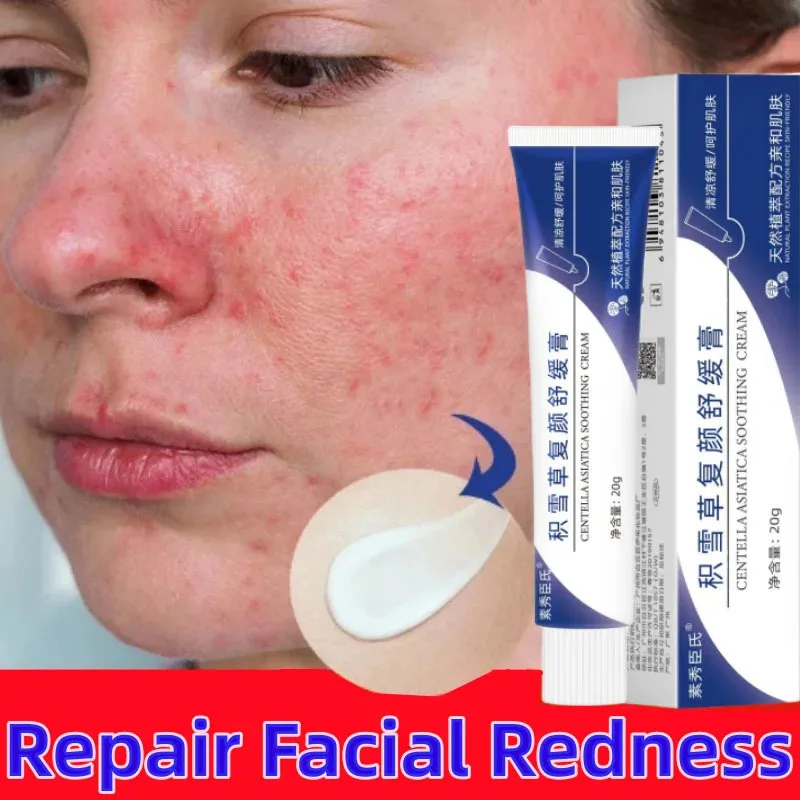 Instant Facial Redness Repair Cream Soothing Red Blood Rosacea Treatment Improve Sensitive Skin Moisturizing Skin Care Cosmetics
Instant Facial Redness Repair Cream Soothing Red Blood Rosacea Treatment Improve Sensitive Skin Moisturizing Skin Care Cosmetics