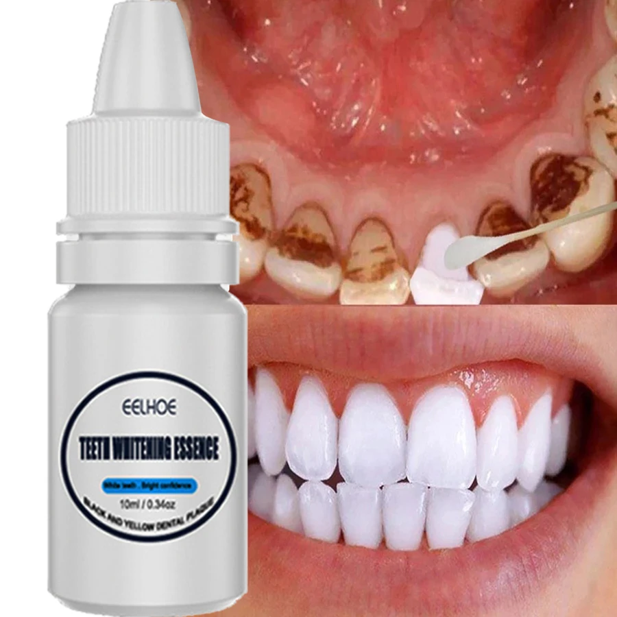 2023 New Teeth Whitening Essence Repair Cavities Caries Clean Oral Hygiene Whiten Teeth Remove Plaque Stains Fresh Breath Dental
2023 New Teeth Whitening Essence Repair Cavities Caries Clean Oral Hygiene Whiten Teeth Remove Plaque Stains Fresh Breath Dental