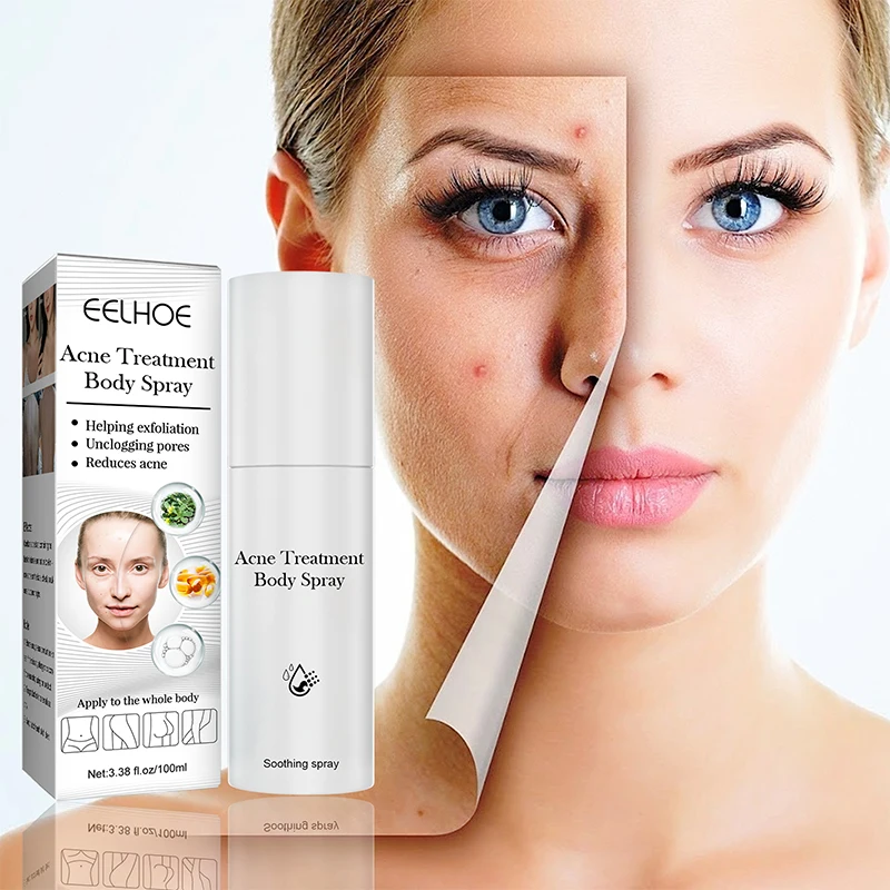 100ml Natural Acne Atomization Moisturizing Anti Acne Removal Scar Pimples Oil Control Acne Spray Soomthing Repair Face Care
100ml Natural Acne Atomization Moisturizing Anti Acne Removal Scar Pimples Oil Control Acne Spray Soomthing Repair Face Care