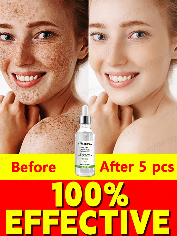 Spot Removal Essence Remove Facial Spots Skin Dark Spots Remove Chloasma Age Spots Sun Spots Whitening and Spot Removal
Spot Removal Essence Remove Facial Spots Skin Dark Spots Remove Chloasma Age Spots Sun Spots Whitening and Spot Removal