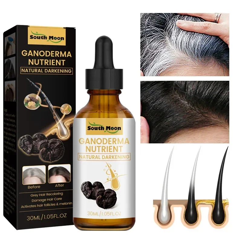 Gray White Hair Treatment Serum Liquid White To Black Natural Color Repair Nourish Product Anti Loss Hair Care Men Women
Gray White Hair Treatment Serum Liquid White To Black Natural Color Repair Nourish Product Anti Loss Hair Care Men Women