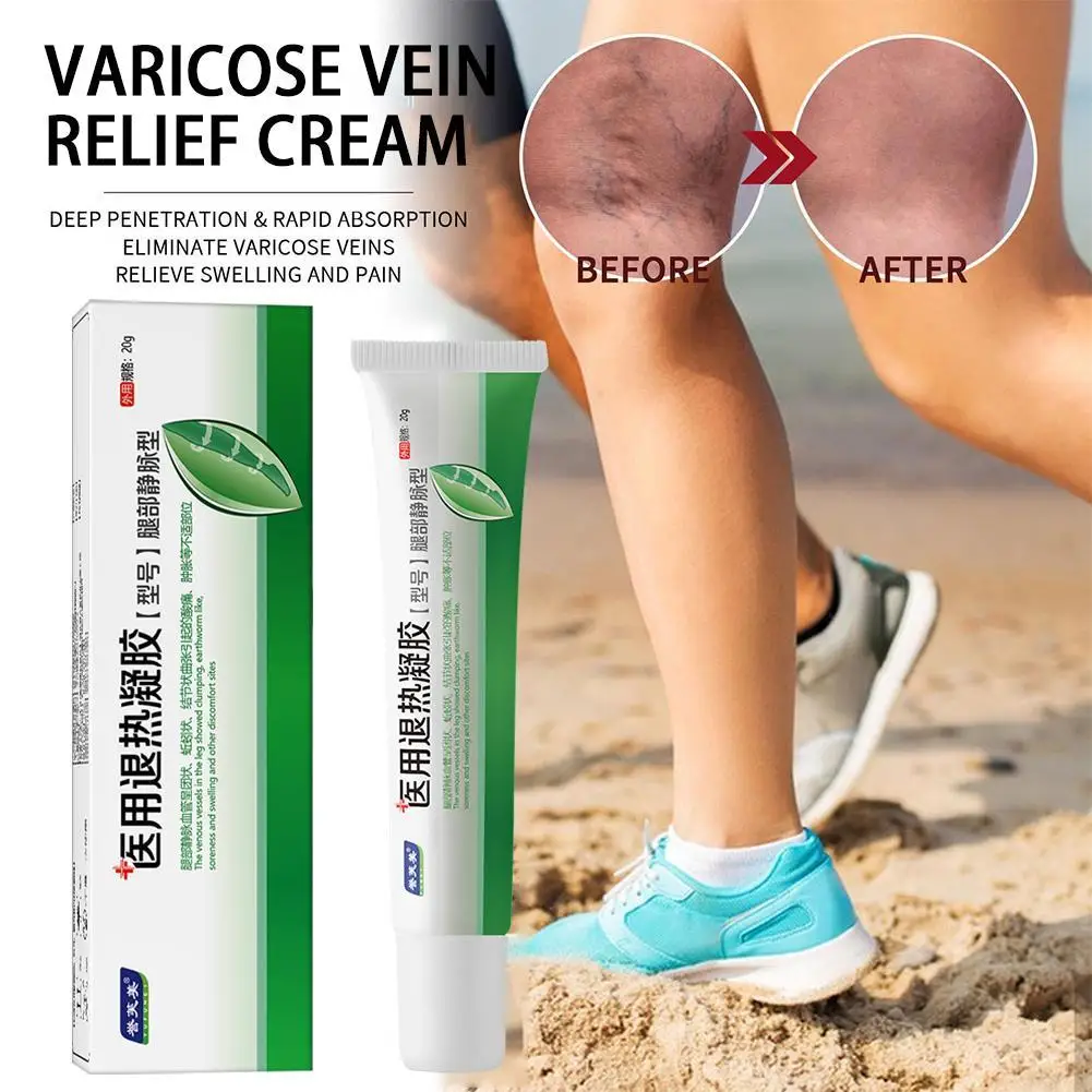 

Potent Formula Ointment For Varicose Veins Effective Varicose Vein Relief Cream To Relieve Vasculitis Phlebitis Spider Pain 20g