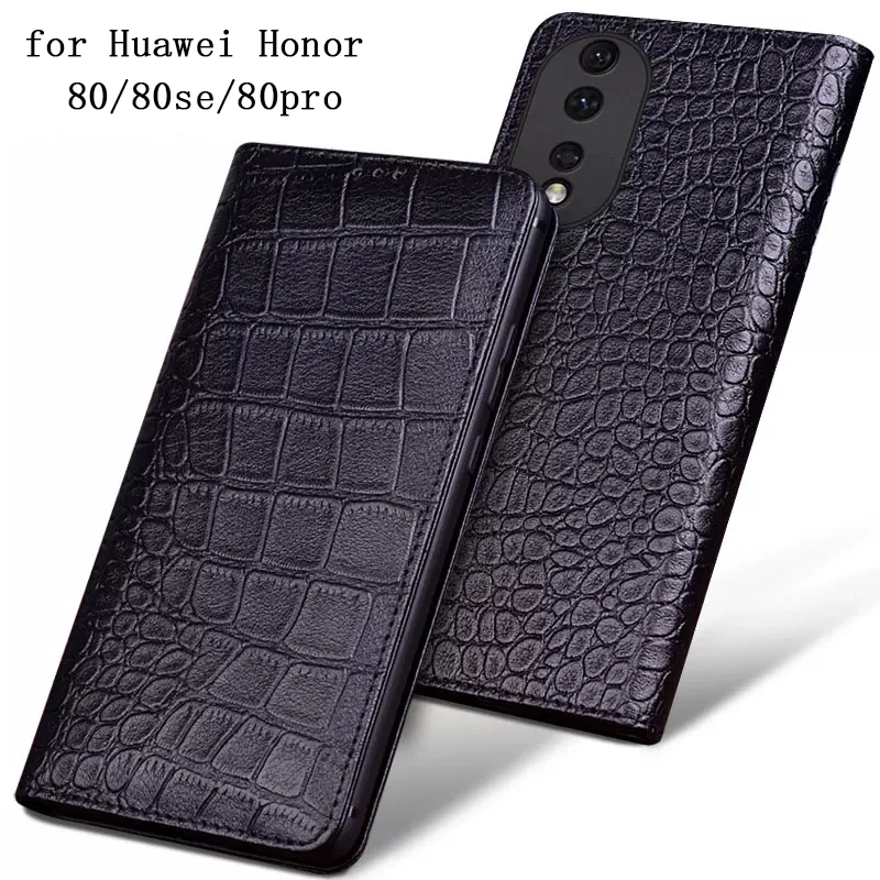 Роскошный чехол из натуральной кожи для Huawei Honor 80 деловой Чехол-книжка для телефона Honor 80pro honor 80se чехол из крокодиловой кожи
Роскошный чехол из натуральной кожи для Huawei Honor 80 деловой Чехол-книжка для телефона Honor 80pro honor 80se чехол из крокодиловой кожи
