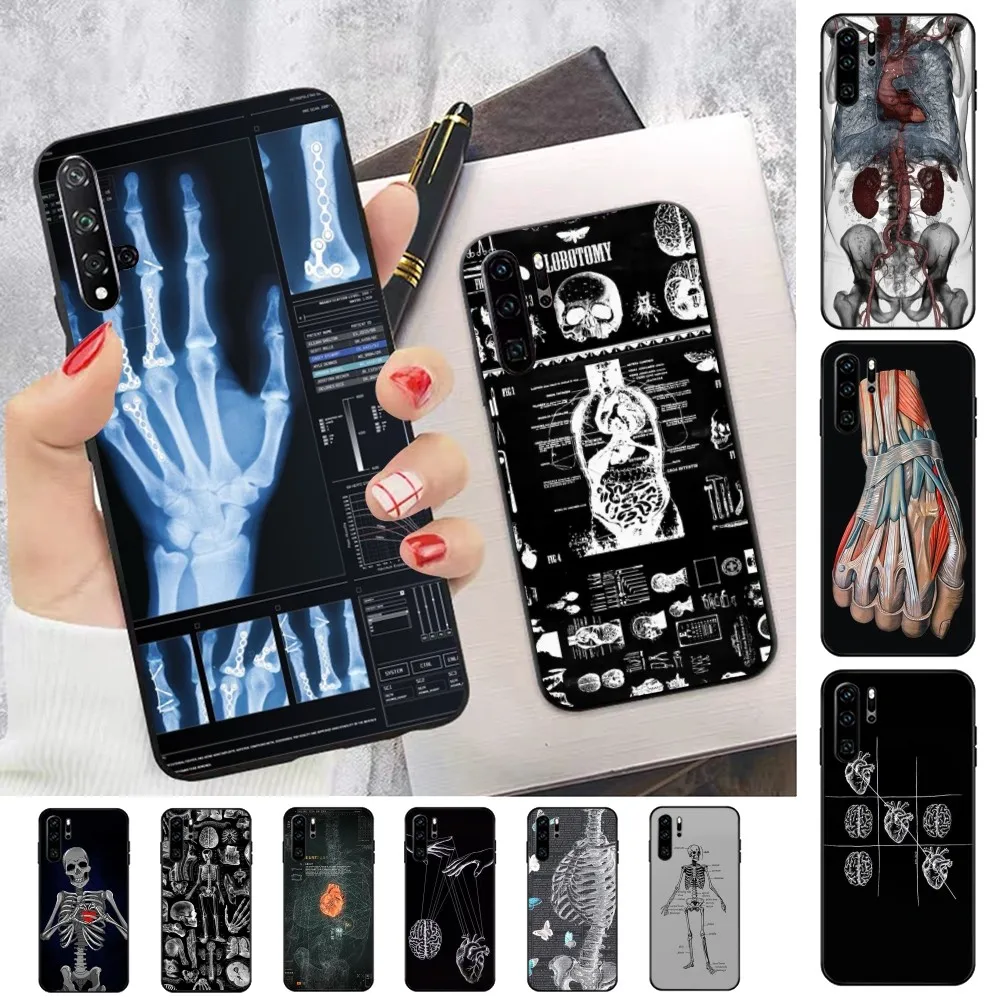 Radiological human organs Skeleton skull Phone Case For Huawei P 8 9 10 20 30 40 50 Pro Lite Psmart Honor 10 lite 70 Mate 20lite
Radiological human organs Skeleton skull Phone Case For Huawei P 8 9 10 20 30 40 50 Pro Lite Psmart Honor 10 lite 70 Mate 20lite