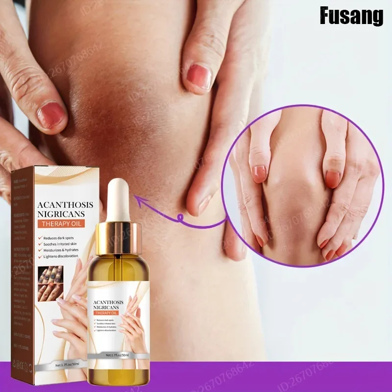 Finger Joint Whitening Essential Oil Women Skin Whiten Serum Fade Melanin Elbow Knee Brighten Essence Dark Knuckle Lighten Serum
Finger Joint Whitening Essential Oil Women Skin Whiten Serum Fade Melanin Elbow Knee Brighten Essence Dark Knuckle Lighten Serum