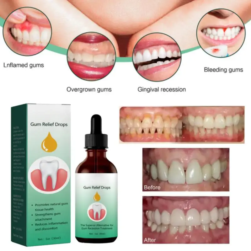 

30ml Gum Care Products Liquid Gum Repair Gum Regrowth Natural Oral Care Drops Gum Restore Oral Gum Care Liquid For Oral Car
