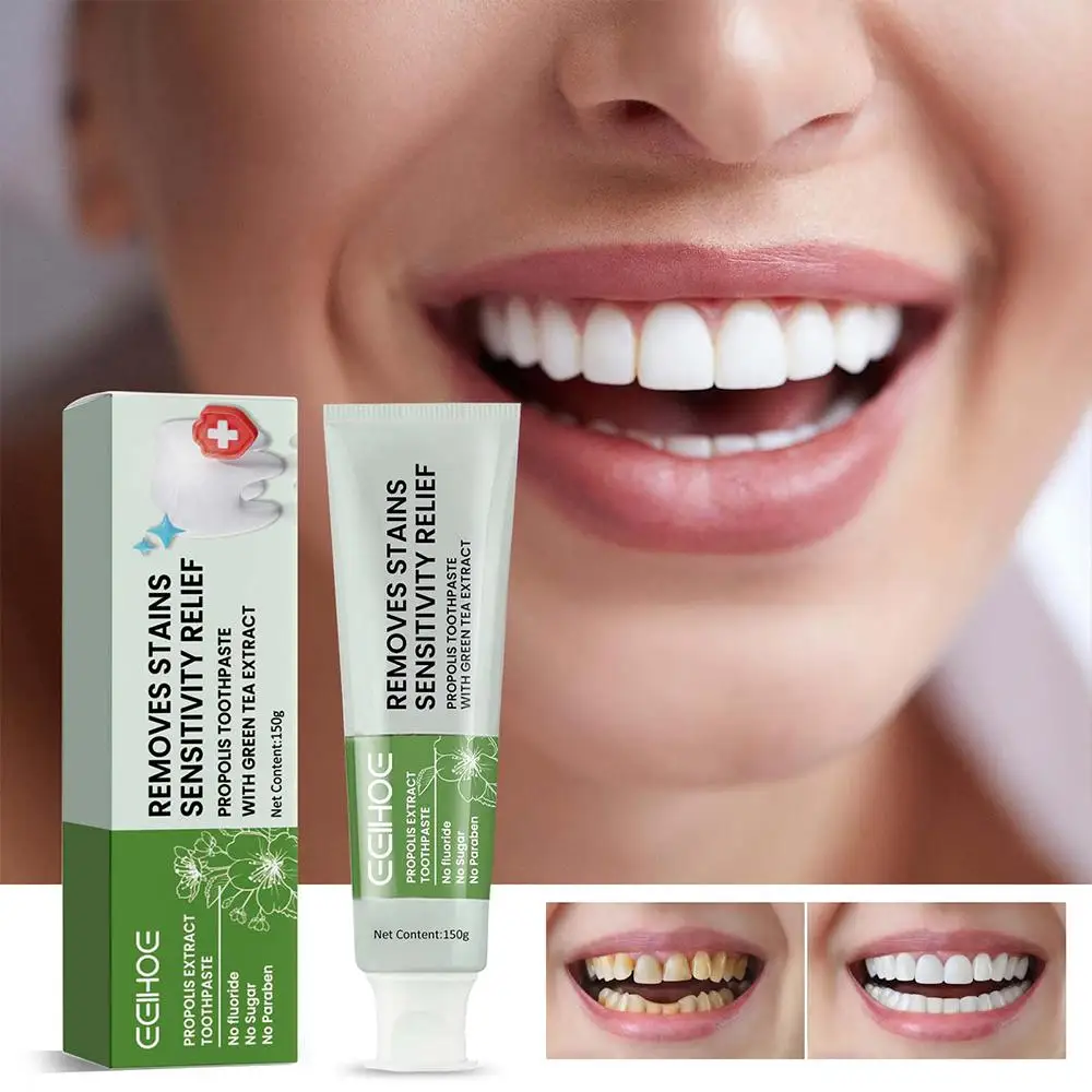 150g Stain Removal Whitening Toothpaste Propolis Anti-plaque Care Dental Fresh Gum Teeth Whitening Cleaning Health Breath O9I0
150g Stain Removal Whitening Toothpaste Propolis Anti-plaque Care Dental Fresh Gum Teeth Whitening Cleaning Health Breath O9I0