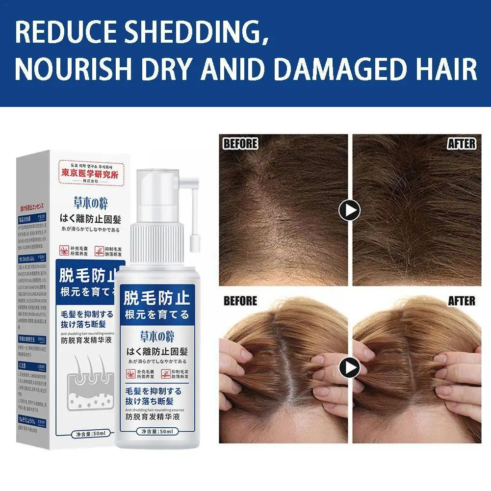 Natural Spray Anti Hair Loss Essential Oil Products Treatment Thinning Frizzy Serum Women Men Growth Hair Care Fast X3T6
Natural Spray Anti Hair Loss Essential Oil Products Treatment Thinning Frizzy Serum Women Men Growth Hair Care Fast X3T6