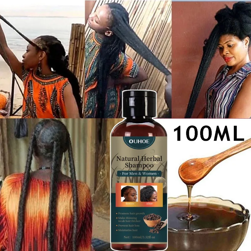 Hair Growth Shampoo Ancient African Hair Growth Formula Extract Powerful Effect Fast Hair Loss Treatment Hair Care 100ml
Hair Growth Shampoo Ancient African Hair Growth Formula Extract Powerful Effect Fast Hair Loss Treatment Hair Care 100ml