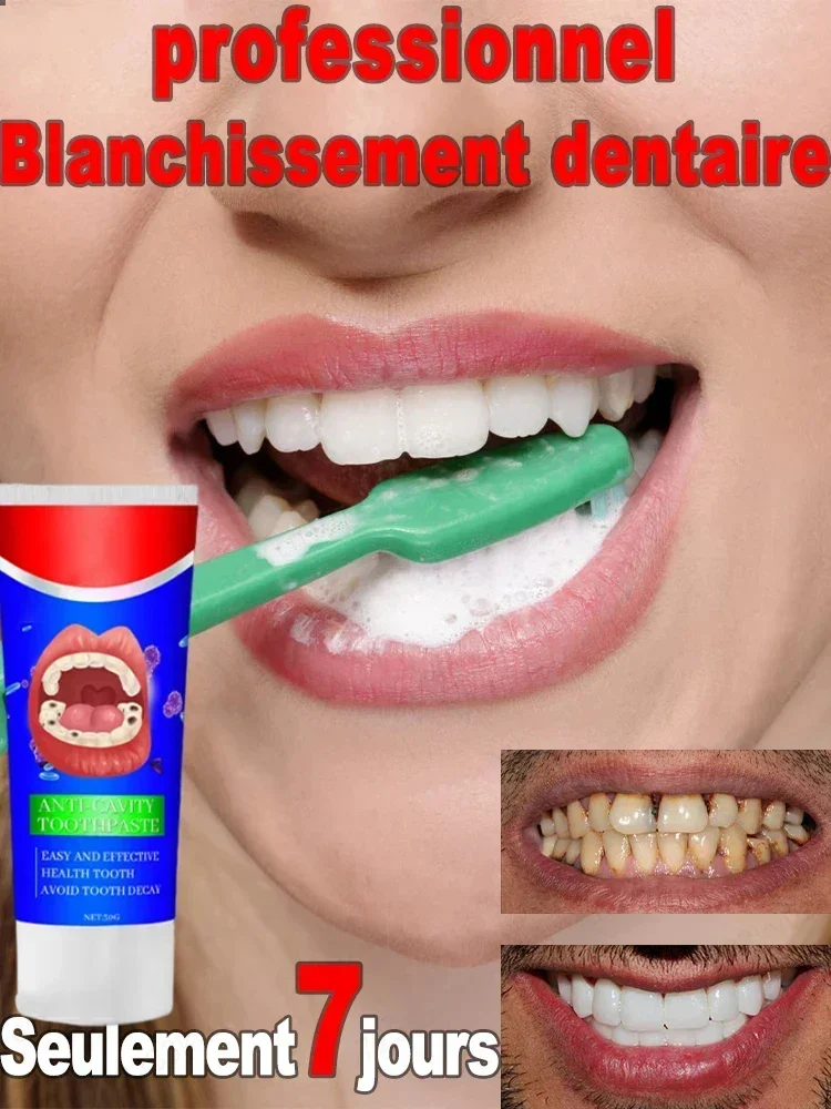 Advanced Dental Care: Teeth whitening anti, Anti-Cavity, Fresh Breath, Plaque Removal, Toothache Relief, Periodontitis Repair
Advanced Dental Care: Teeth whitening anti, Anti-Cavity, Fresh Breath, Plaque Removal, Toothache Relief, Periodontitis Repair