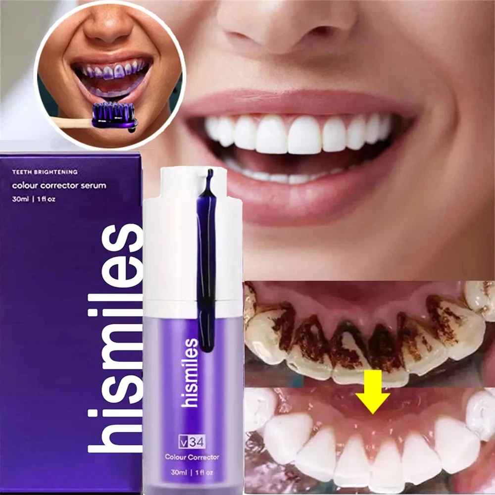 Hismile V34 Purple Toothpaste Whitening Teeth Remove Plaque Stains Oral Hygiene Cleaning Dental Tools Fresh Breath Beauty Health
Hismile V34 Purple Toothpaste Whitening Teeth Remove Plaque Stains Oral Hygiene Cleaning Dental Tools Fresh Breath Beauty Health