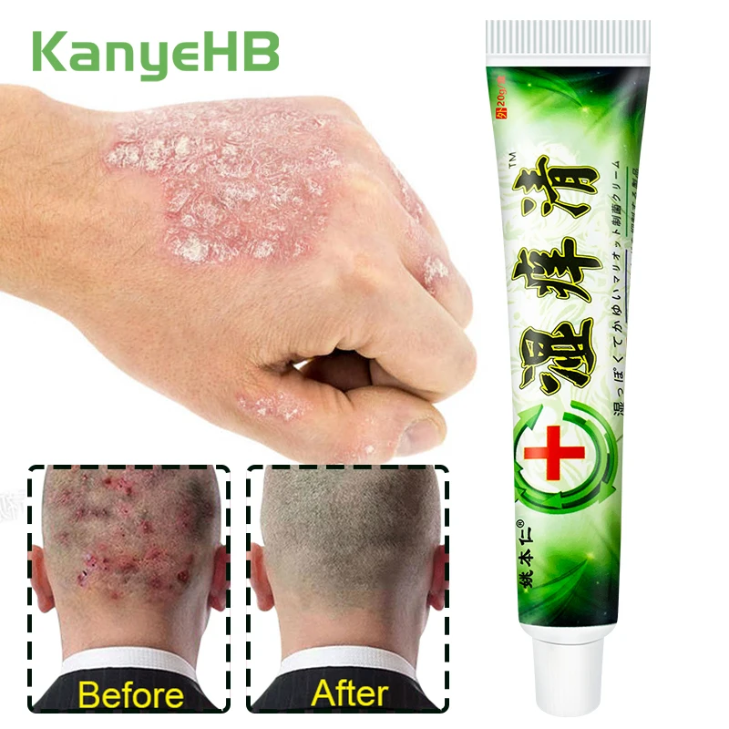 1Pcs Eczema Cream Psoriasis Antibacterial Ointment Treatment Rash Dermatitis Herbal Anti-itching Skin Care Medical Cream S052
1Pcs Eczema Cream Psoriasis Antibacterial Ointment Treatment Rash Dermatitis Herbal Anti-itching Skin Care Medical Cream S052