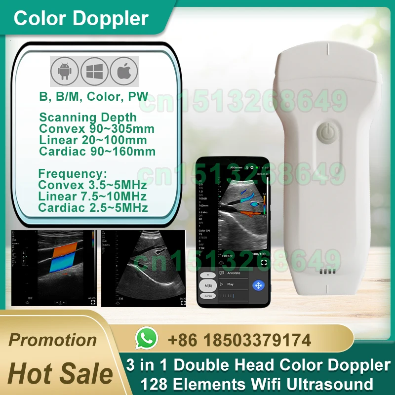 128 элементов, цветной Доплер-зонд, Беспроводной ультразвуковой зонд 3-в-1 с двойной головкой для систем Android, IOS, Windows
128 элементов, цветной Доплер-зонд, Беспроводной ультразвуковой зонд 3-в-1 с двойной головкой для систем Android, IOS, Windows