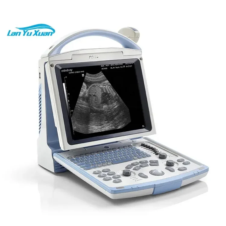 

Ultrasonido Mindray DP10 Convex Linear Probe Portable Digital Ultrasound Scanner Machine DP10 Mindray Cheapest Price