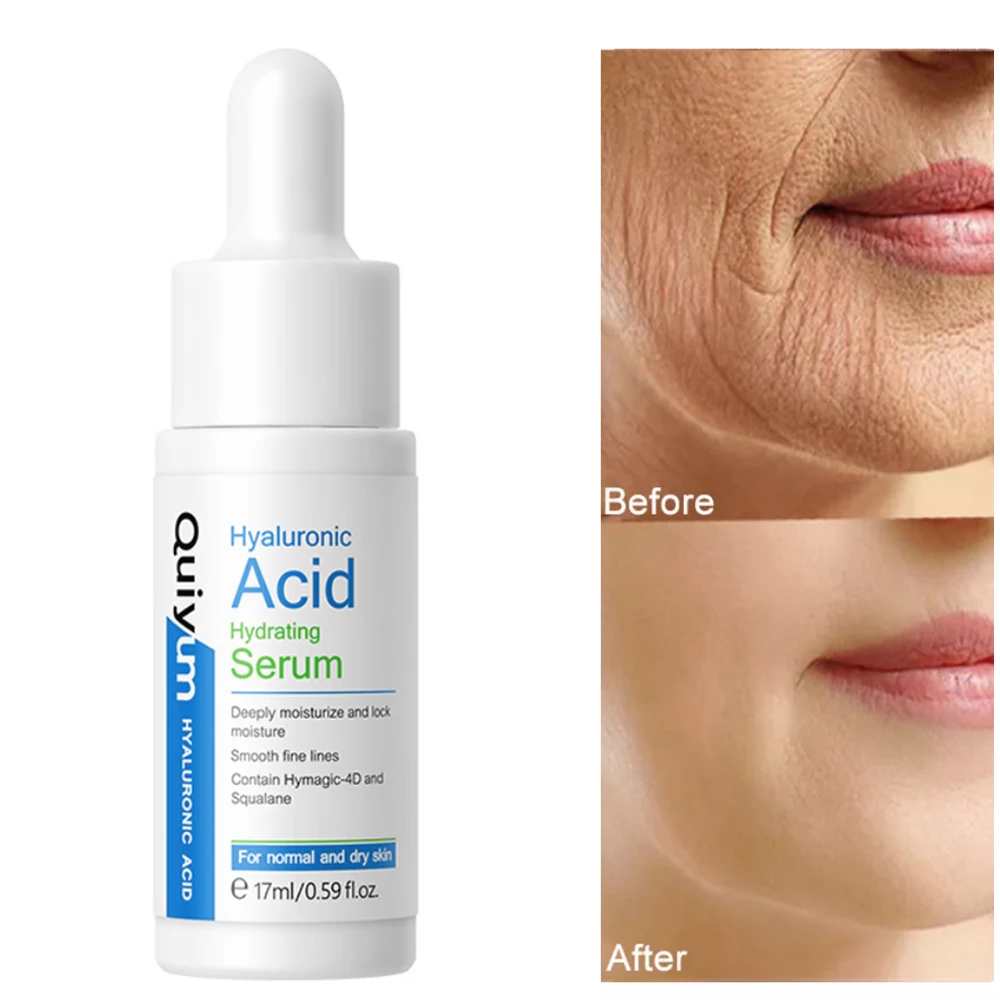 Отбеливающая сыворотка с гиалуроновой кислотой для лица, антивозрастной, антивозрастной
Отбеливающая сыворотка с гиалуроновой кислотой для лица, антивозрастной, антивозрастной