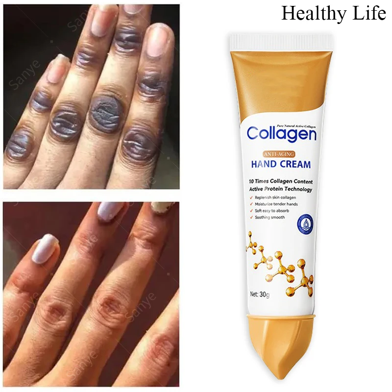 

Get Rid Of Dark Knuckles In 7 Days Serum Whitening Knuckle Dull Removal Cream For Hand Dark Spots Elbows Pigmentation Correctors
