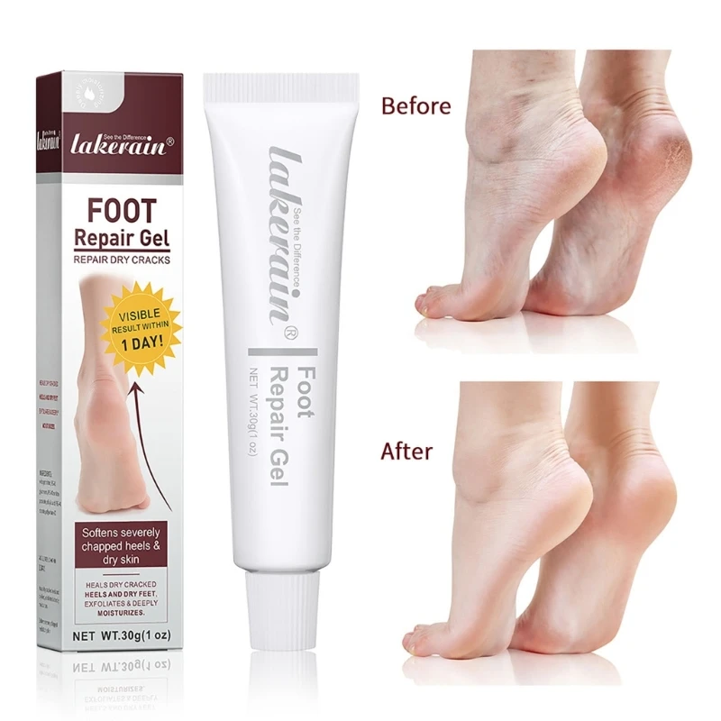 Professional Foot Repair Cream for Dry Cracked Feet Nourishes Revitalizes Skin Drop Shipping
Professional Foot Repair Cream for Dry Cracked Feet Nourishes Revitalizes Skin Drop Shipping