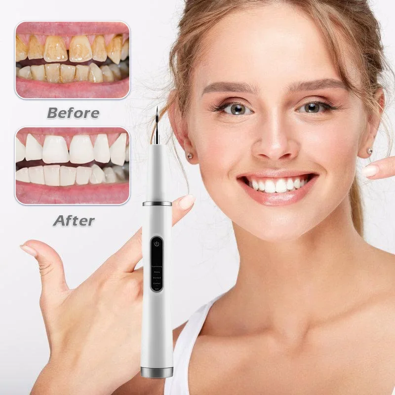 Home Ultrasonic Electric Dental Cleaner Dental Calculus Tartar Cleaning and Whitening Dental Flusher Dental Cleaner
Home Ultrasonic Electric Dental Cleaner Dental Calculus Tartar Cleaning and Whitening Dental Flusher Dental Cleaner