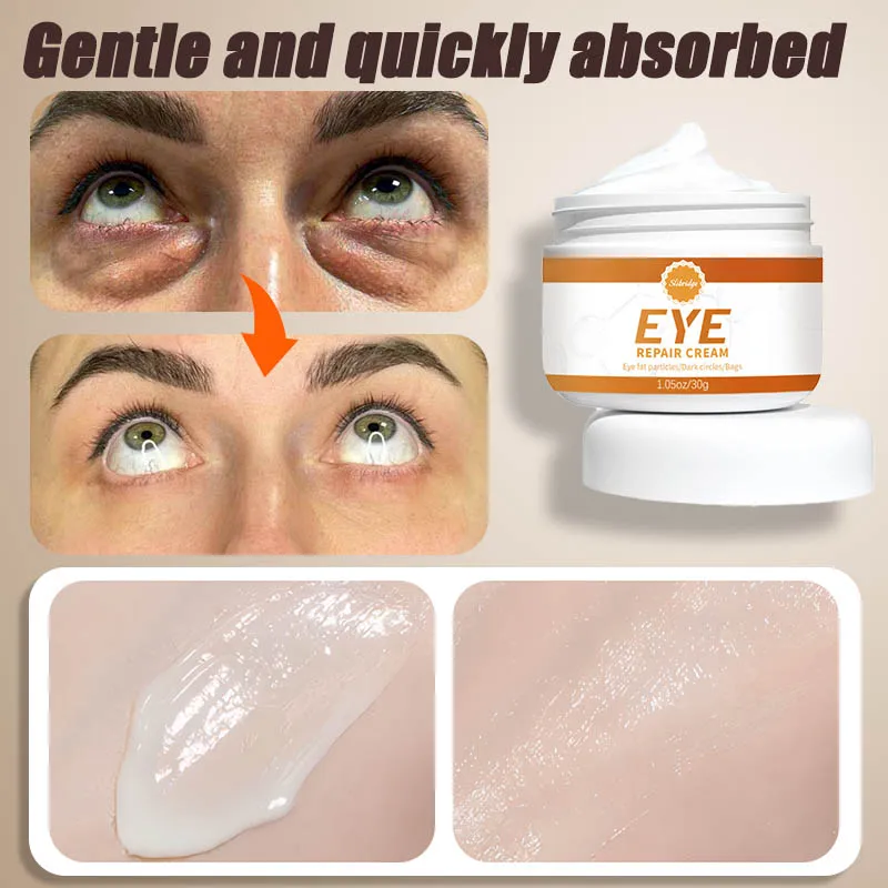 

Dark circles cream and eye bag anti bags in the eyes circle remover