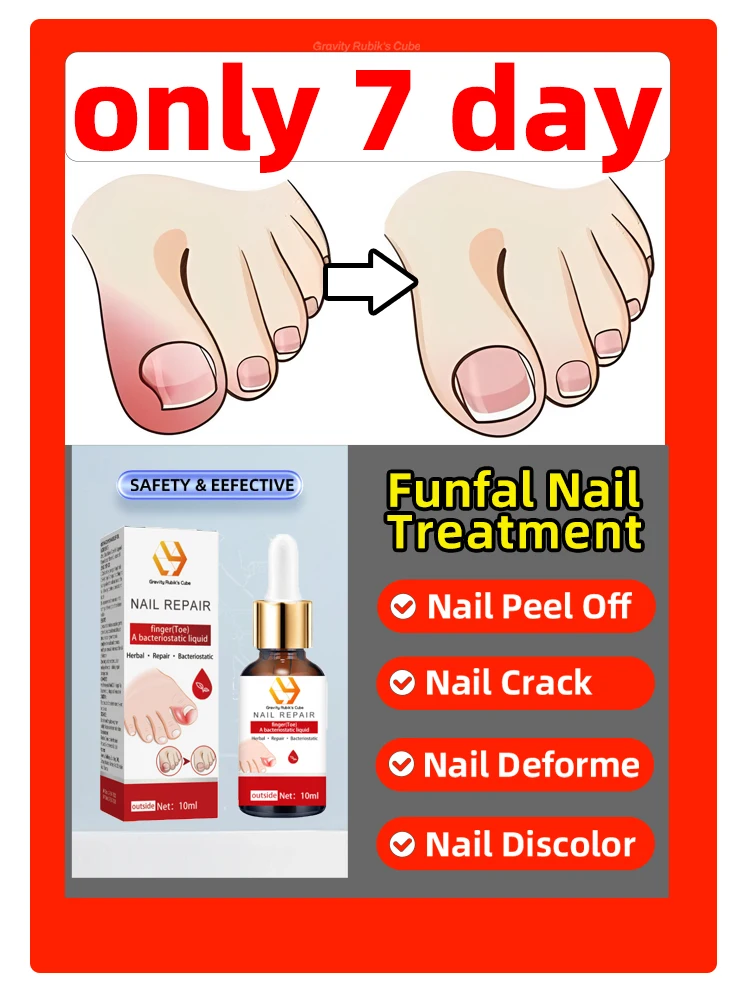 

Fungus Nails Fungal Nail Repair Fast Onychomycosis