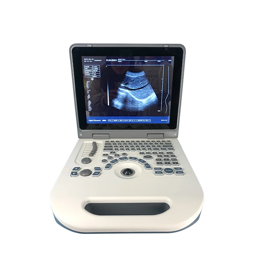 Affordable price portable ultrasound machine for facial injections fat scanning anesthesia MSK use
Affordable price portable ultrasound machine for facial injections fat scanning anesthesia MSK use