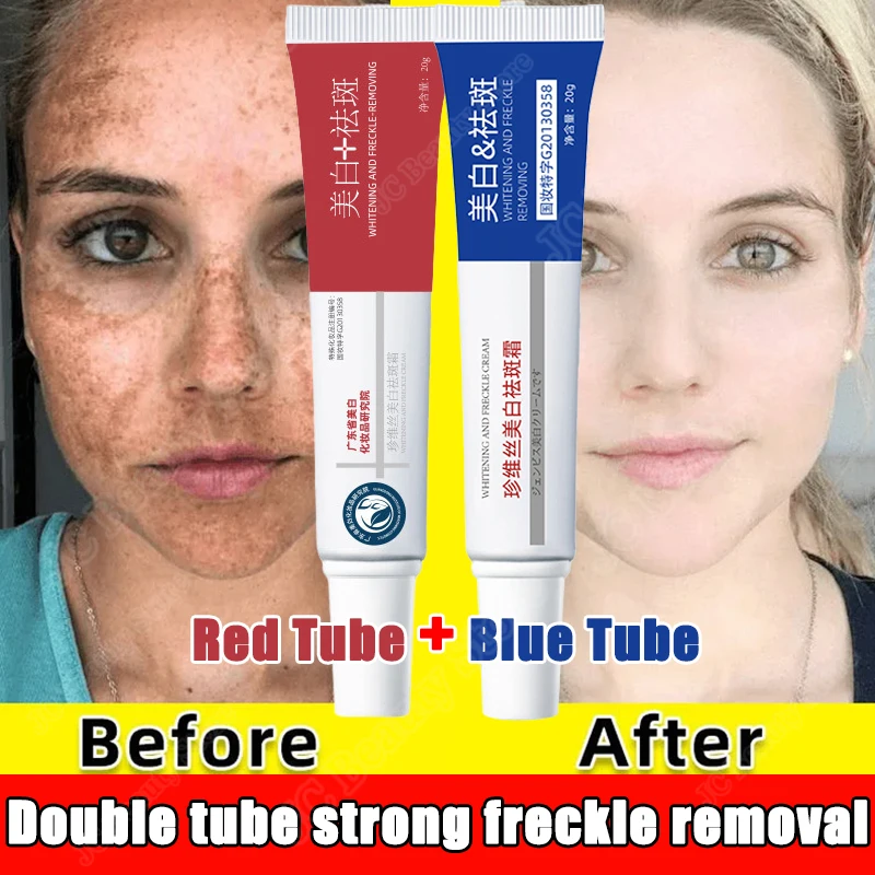 Whitening Freckle Cream Dark Spot Remover Spot Corrector Moisturizing Brighten Pigment Correction Face Beauty Health Skin Care
Whitening Freckle Cream Dark Spot Remover Spot Corrector Moisturizing Brighten Pigment Correction Face Beauty Health Skin Care