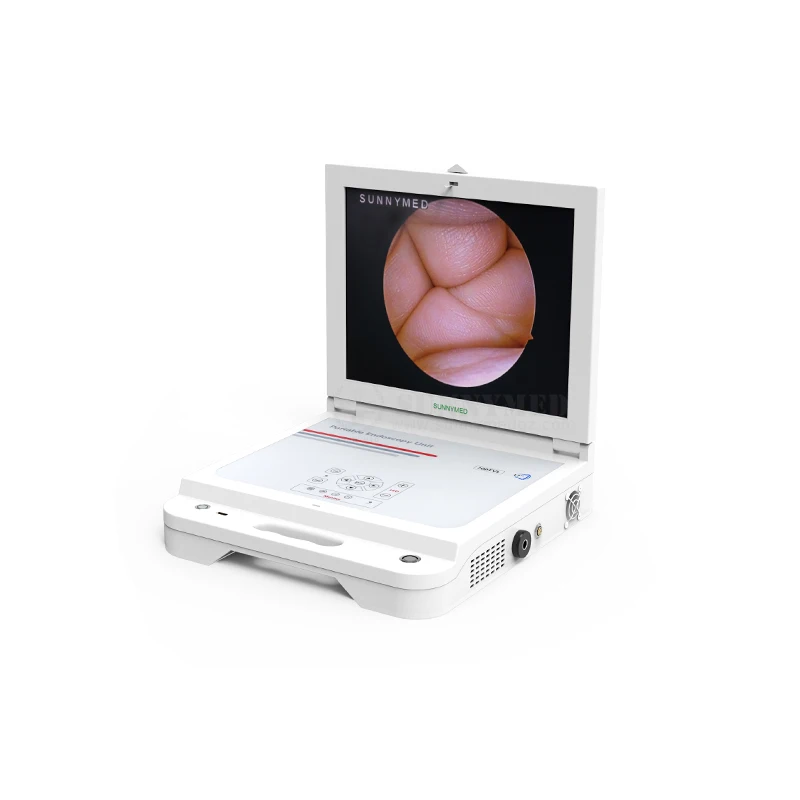 SY-PS045N 17 Inch Portable Endoscopy Unit 4 in 1 Hysteroscopic System Endoscope
SY-PS045N 17 Inch Portable Endoscopy Unit 4 in 1 Hysteroscopic System Endoscope