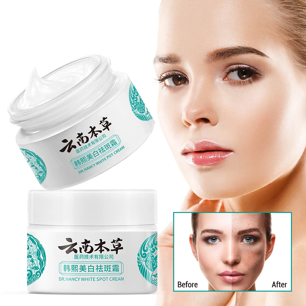 

Freckle Removal Cream 20g Replenish Whitening Moisturizing Block Melanin Dilute Spots Repair Skin Lightening Facial Care