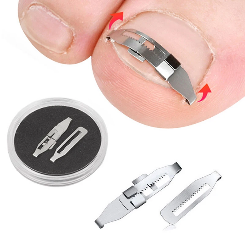 2pcs Ingrown Toenail Corrector Tools Pedicure Recover Embed Toe Nail Treatment Professional Foot Care Correction Tool Care Foot
2pcs Ingrown Toenail Corrector Tools Pedicure Recover Embed Toe Nail Treatment Professional Foot Care Correction Tool Care Foot