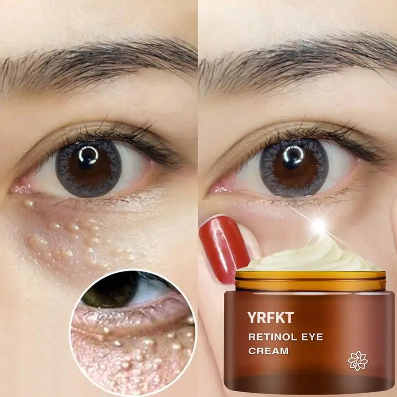 Retinol Eye Cream Dark Circles Fade Fine Lines Remove Eye Bags Firming Brighten Skin
Retinol Eye Cream Dark Circles Fade Fine Lines Remove Eye Bags Firming Brighten Skin