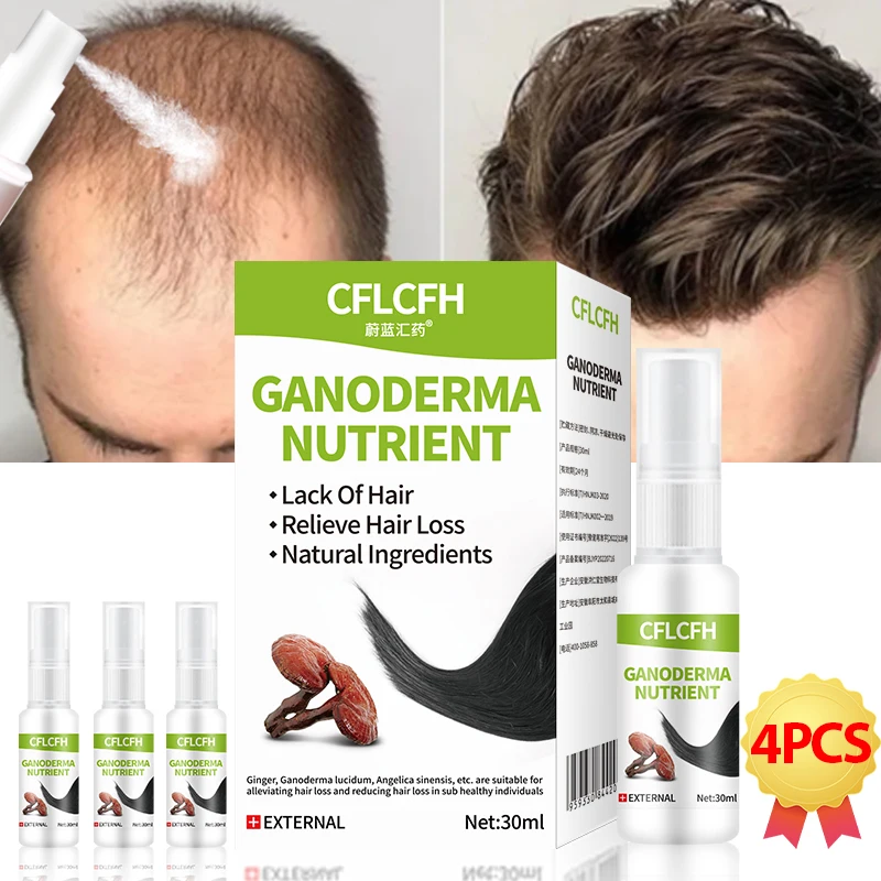 Hair Growth Spray Scalp Hair Regrowth Care Product for Men Women Anti Hair Loss Treatment Ganoderma Lucidum Ginger Liquid
Hair Growth Spray Scalp Hair Regrowth Care Product for Men Women Anti Hair Loss Treatment Ganoderma Lucidum Ginger Liquid