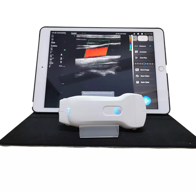 

MC27 Most welcomed portable wifi wireless color doppler ultrasound ecografo probe with convex, cardiac and linear functions