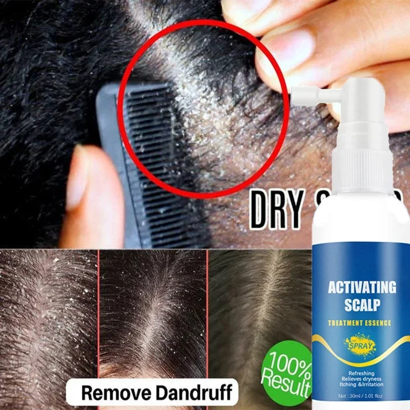 30ml Scalp Cleansing Spray Nourishing Oil Control Anti-Dandruff Prevent Loss Repair Refreshing Exfoliating Hair Care Products
30ml Scalp Cleansing Spray Nourishing Oil Control Anti-Dandruff Prevent Loss Repair Refreshing Exfoliating Hair Care Products