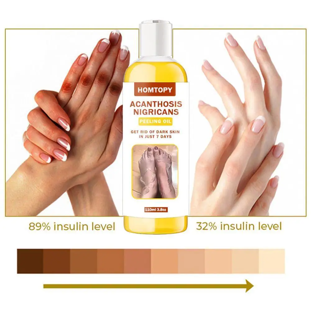 Yellow Peeling Oil Bleaching Dark Skin Lighten Elbows Knees Whitening Effective Serum Body Care Even Tone Hands C2D2
Yellow Peeling Oil Bleaching Dark Skin Lighten Elbows Knees Whitening Effective Serum Body Care Even Tone Hands C2D2
