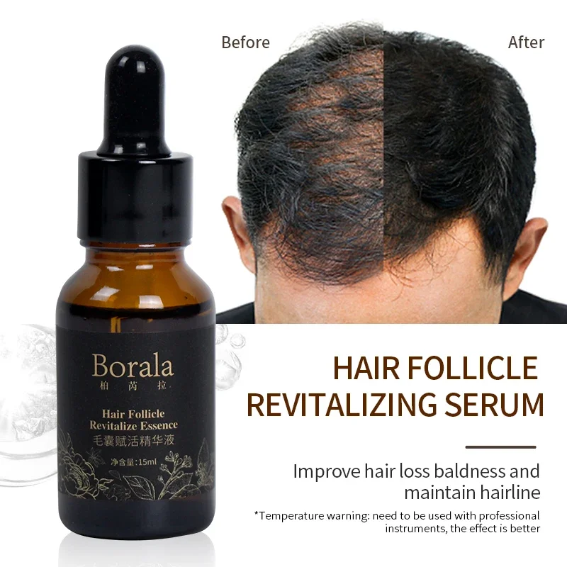 

Borala Hair Care Follicle Activating Essence for Beauty Health Hair Growth Oil Hair Scalp Treatment Anti Loss Products