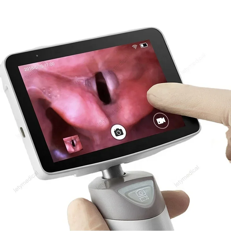 

HD Video Laryngoscope electronic Intubation laryngoscope Wifi Touch display screen Photo taking recording