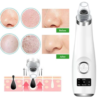 Blackhead Vacuum Cleaner Pore Ance Black suction Dots Extractor face Cleansing Pimple Tool Remover with 4 modes 3 kinds suction
Blackhead Vacuum Cleaner Pore Ance Black suction Dots Extractor face Cleansing Pimple Tool Remover with 4 modes 3 kinds suction