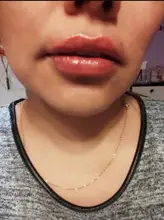 Neurami-ácido hialurónico labial, 1ml, reticulado, aumento de labios, para pluma hialurón