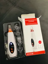 Removedor profundo espinilla profesional, limpieza de poros, vacío, belleza Facial, cuidado de la piel, herramientas