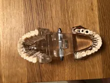 1 Uds implante Dental enfermedad dientes modelo restauración puente Diente de dentista para la ciencia médica enfermedad Dental estudio pedagógico