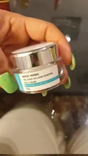 Chumolee blanqueamiento potente crema Crema para pecas elimina el Melasma acné pigmento oscuro puntos melanina grano brillo Crema de Cara