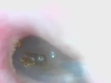 Cámara endoscópica 3 en 1 impermeable, endoscopio de limpieza de orejas de 5,5mm, 6 luces LED HD, otoscopio Visual para oreja, nariz y boca, recolector de cera para los oídos Cl