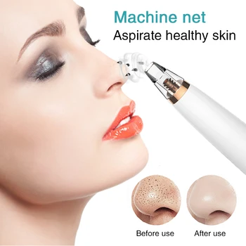 LCD Electric Blackhead Remover For Face Pore Acne Black Dots Vacuum Suction Remove Machine Diamond Beauty Facial Skin Care Tool 
LCD Electric Blackhead Remover For Face Pore Acne Black Dots Vacuum Suction Remove Machine Diamond Beauty Facial Skin Care Tool