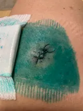 10 unids/caja impermeable tirita mariposa adhesivo herida cierre tirita Kit de emergencia vendas adhesivas