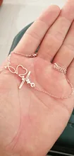 Todorova-pulsera de acero inoxidable con latido del corazón para mujer, brazalete con estetoscopio, regalos especiales para enfermera, joyería para médico