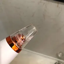 Removedor profundo espinilla profesional, limpieza de poros, vacío, belleza Facial, cuidado de la piel, herramientas