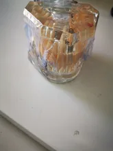 1 Uds implante Dental enfermedad dientes modelo restauración puente Diente de dentista para la ciencia médica enfermedad Dental estudio pedagógico